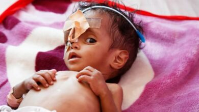 صورة الأمم المتحدة: انعدام الأمن الغذائي باليمن في أسوأ مستوياته منذ 4 سنوات