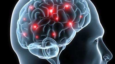 Scientists discover new 'sleep node' in brain