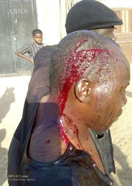 Photo of Thugs attack Imam Hussain mourners in Jos, Nigeria