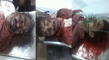 Photo of Two Pakistani Shia martyred, one injured by terrorists in Karachi
