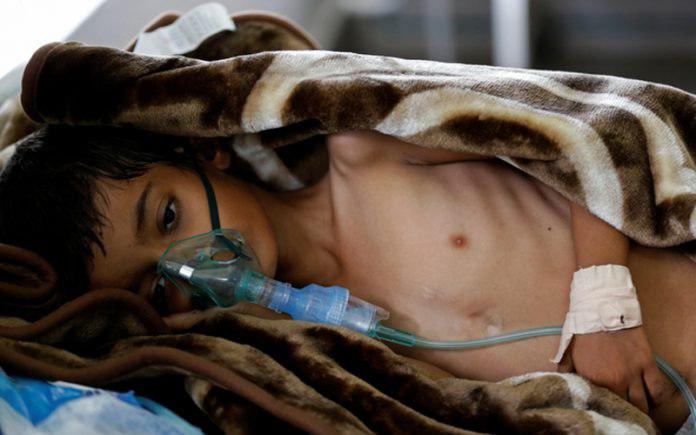 Photo of WHO: Cholera kills 2,018 people in Yemen