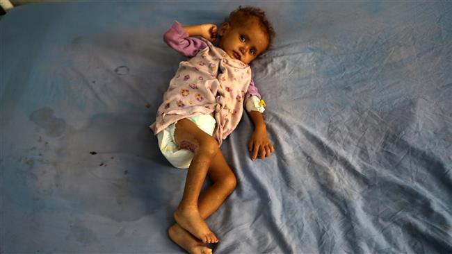 Photo of Over 75 percent of Yemenis in need of aid: UN