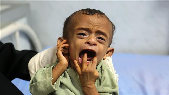 Photo of UN aid agency calls for nearly $3 billion in humanitarian aid for Yemen