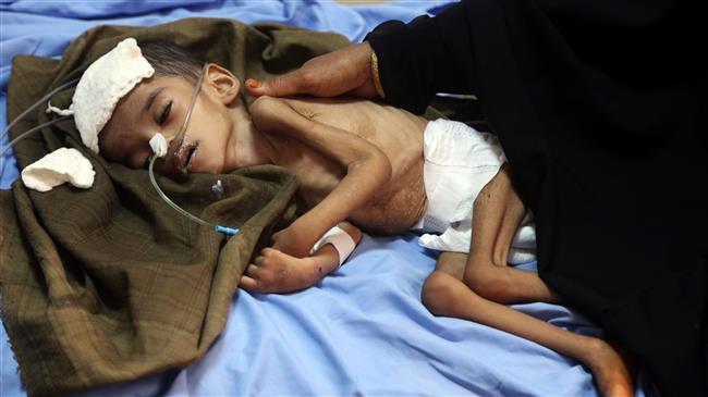 Photo of UNICEF slams ‘carnage’ of over 2,200 Yemeni children