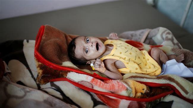 Photo of 5.2 million Yemeni kids on brink of famine amid Saudi war: Charity