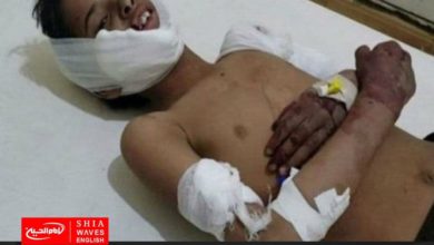 Photo of Yemeni child wounded by a bomb left over from the Saudi aggression