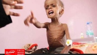 Photo of 400 thousand Yemeni children suffer from acute malnutrition