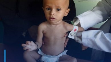 Photo of WHO: 75% of Yemeni children suffer from chronic malnutrition