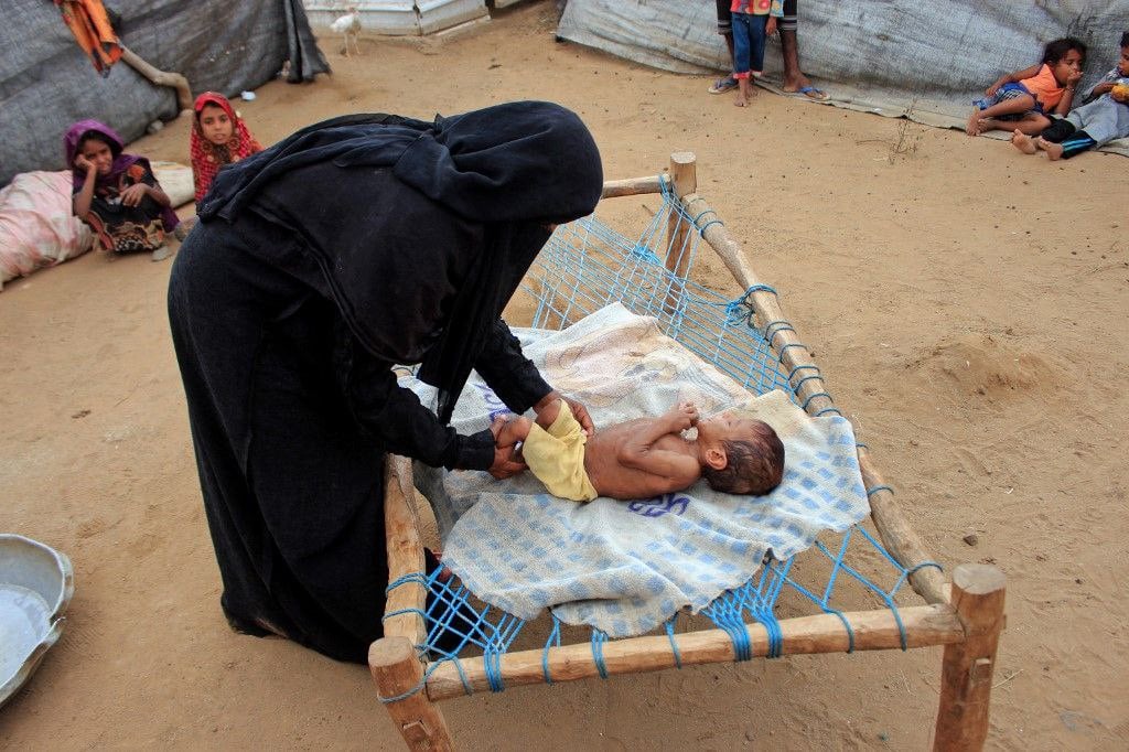 UNICEF says over 2 million children in Yemen suffer acute malnutrition ...