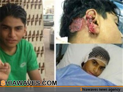 تصویر مجروح شدن بدون دلیل نوجوان عربستانی
