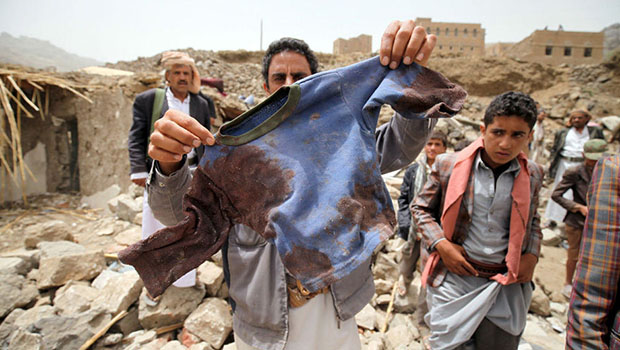 تصویر جلوگيرى عربستان از بازديد هيأت سازمان ديده بان حقوق بشر از وضعيت انسانى در يمن