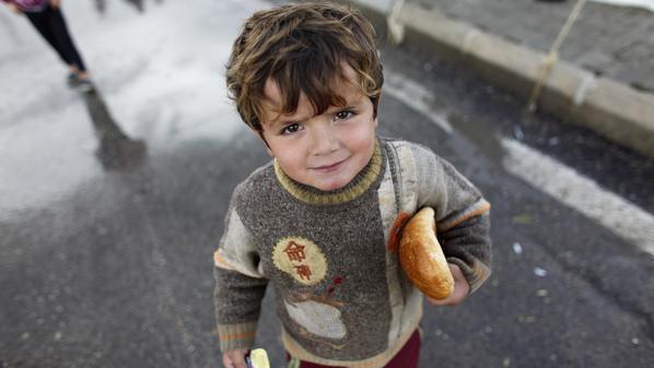 تصویر هشدار یونیسف درباره سوء تغذیه شدید کودکان سوری