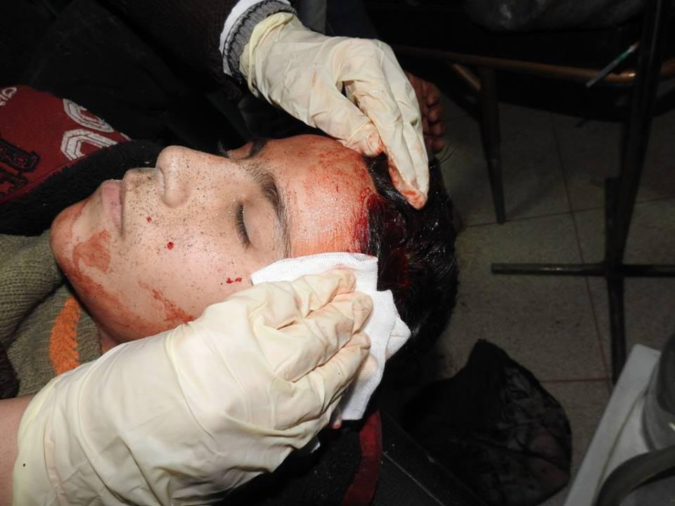 تصویر دو شهید و ۸ زخمی در حمله خمپاره ای به فوعه و کفریا
