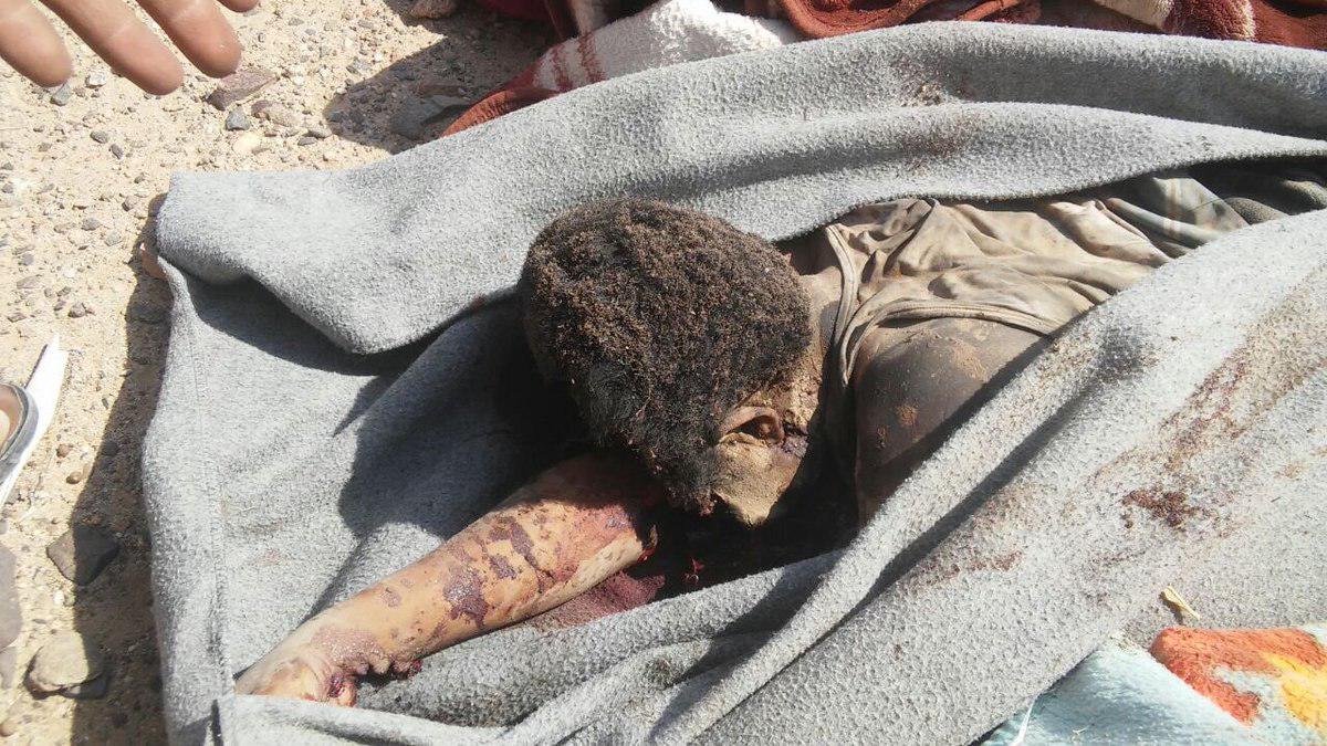 تصویر ۱۰ شهید و زخمی درپی حمله جنگنده‌های سعودی به آمبولانس مجروحان یمنی