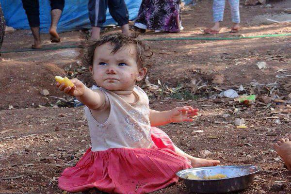تصویر سوء تغذیه کودکان جنگزده سوری