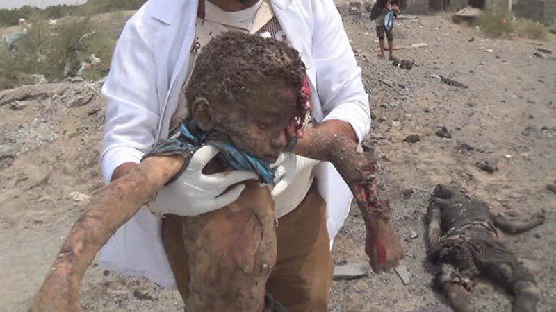 تصویر حمله هوایی ائتلاف سعودی به آورگان یمنی