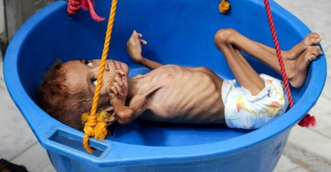 تصویر سازمان ملل: درحال باختن جنگ علیه قحطی در یمن هستیم/یمنی‌ها درحال خوردن علف هستند