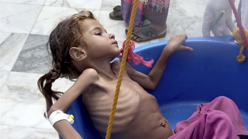 تصویر هشدار چندباره سازمان ملل: یمن در آستانه قحطی بزرگ است