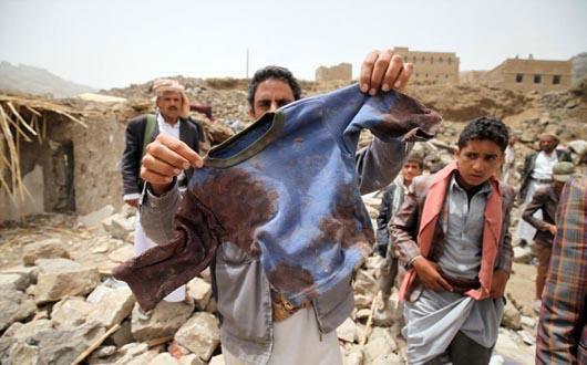 تصویر به خاک و خون کشیده شدن یک خانواده یمنی در حمله جنگنده‌های سعودی