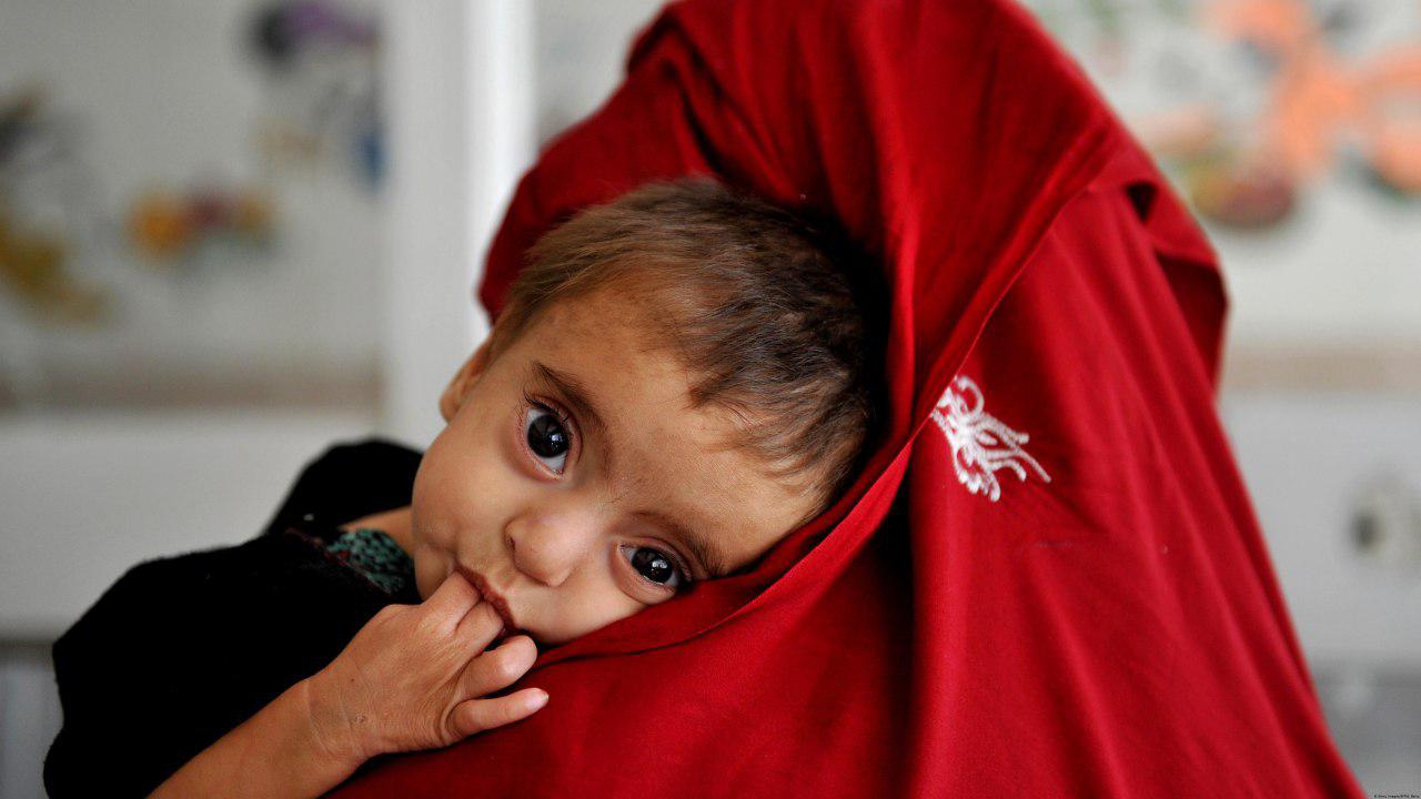 تصویر هشدار یونیسف در مورد خطر مرگ کودکان افغانستانی بر اثر گرسنگی