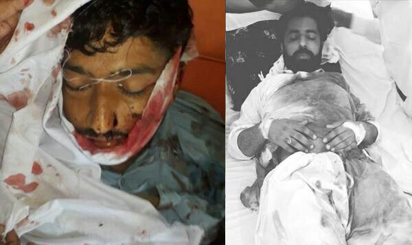 تصویر ادامه اقدامات تروریستی سنی های تندرو علیه شیعیان در پاکستان