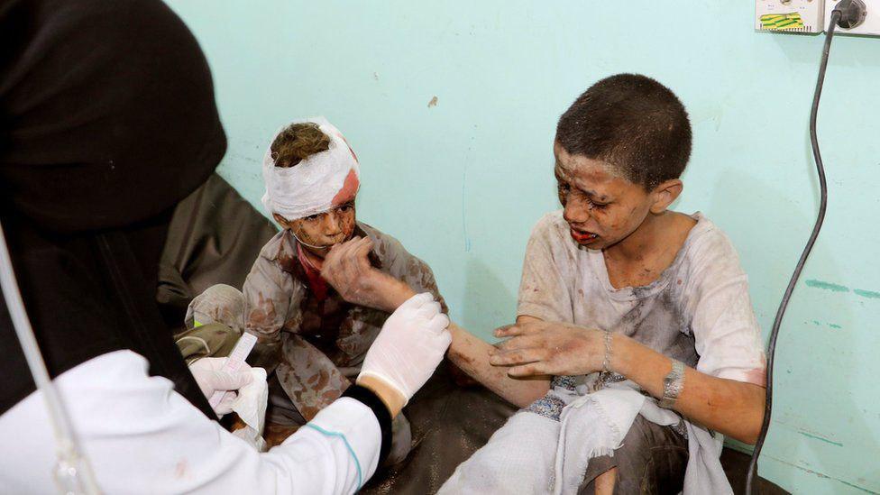 تصویر معلول شدن ۸۰۰ کودک در جنگ ائتلاف سعودی علیه یمن