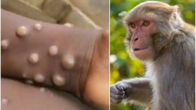 تصویر افزایش سه برابری مبتلایان به آبله میمون در جهان