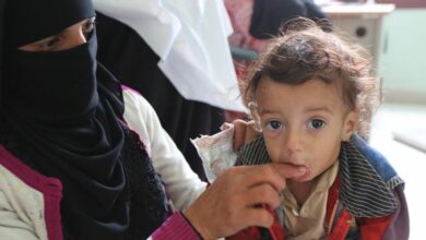 تصویر بحران انسانی در یمن؛ ۲.۲ میلیون کودک یمنی از سوء تغذیه شدید رنج می‌برند