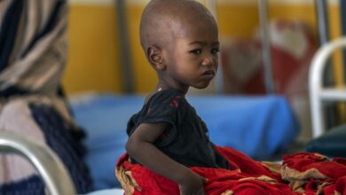 تصویر درخواست دوباره سازمان ملل برای کمک فوری با هدف مقابله با سوء تغذیه کودکان جهان