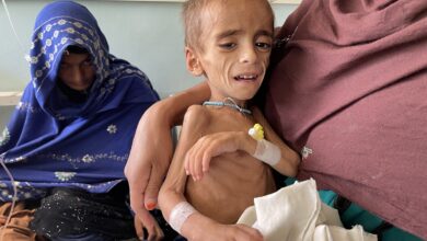 تصویر مردم افغانستان، یمن و پنج کشور دیگر با خطر مرگ ناشی از گرسنگی مواجه‌ اند