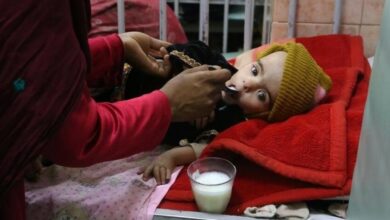 نگرانی سازمان ملل از افزایش سوء تغذیه کودکان در افغانستان