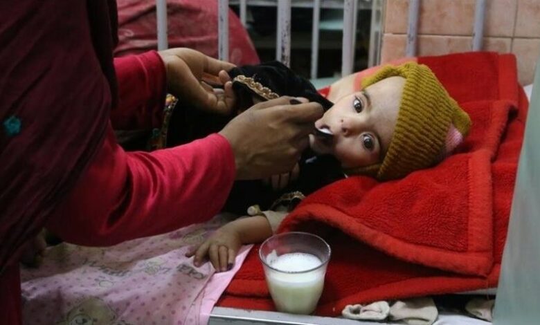نگرانی سازمان ملل از افزایش سوء تغذیه کودکان در افغانستان