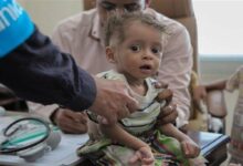 یونیسف: ۴۱ هزار کودک در یمن بر اثر بیماری‌های قابل پیشگیری جان خود را از دست داده‌اند