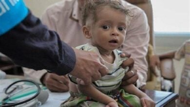 یونیسف: ۴۱ هزار کودک در یمن بر اثر بیماری‌های قابل پیشگیری جان خود را از دست داده‌اند