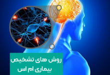 تشخیص زودهنگام علائم خاص بیماری ام اس می‌تواند ناتوانی‌های طولانی مدت را بهبود بخشد