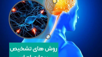 تشخیص زودهنگام علائم خاص بیماری ام اس می‌تواند ناتوانی‌های طولانی مدت را بهبود بخشد