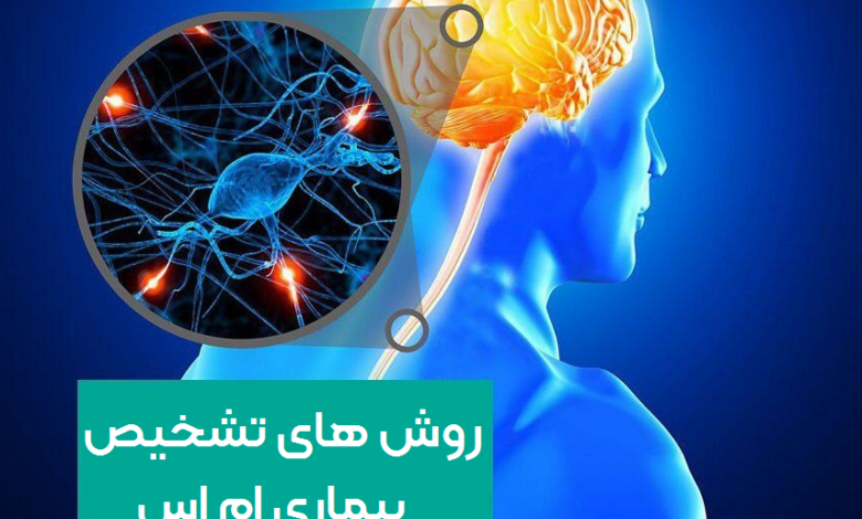 تشخیص زودهنگام علائم خاص بیماری ام اس میتواند ناتوانیهای طولانی مدت را بهبود بخشد