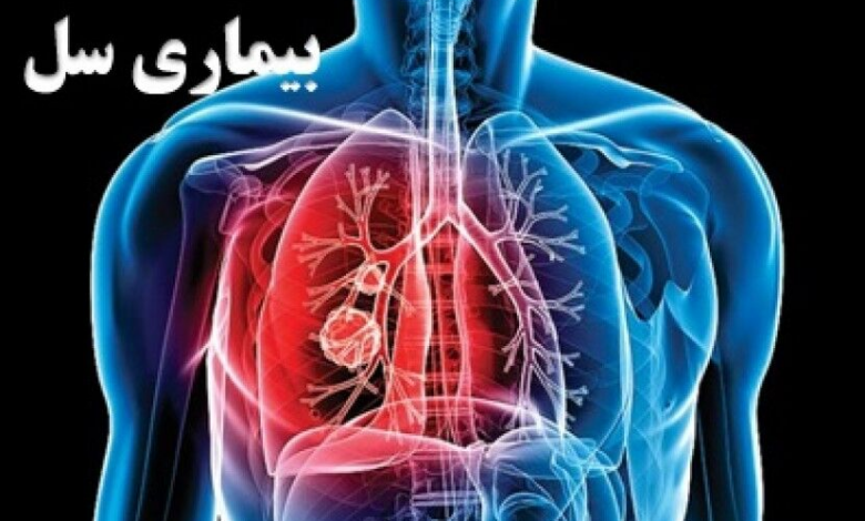 اولین آزمایش پیش صلاحیت تشخیص بیماری سل