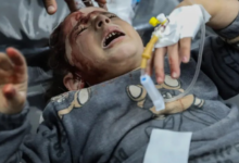 کمیسر اونروا: کشته و زخمی شدن روزانه 100 کودک در غزه فاجعه‌ای هولناک است