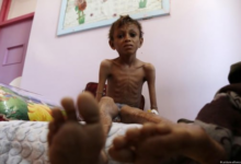 UNICEF, Yemen'de Artan Yetersiz Beslenme Konusunda Uyarıda Bulundu