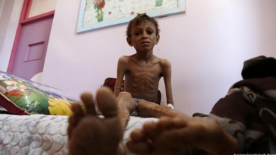 UNICEF, Yemen'de Artan Yetersiz Beslenme Konusunda Uyarıda Bulundu