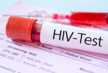 ABD Dış Yardımlarını Keserken AIDS Krizi Geri Döndü
